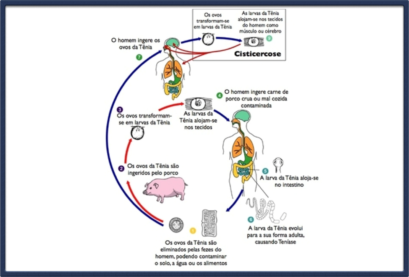 Neurocisticercoses (parasita no cérebro) – Dr. Gonzalo Castillo
