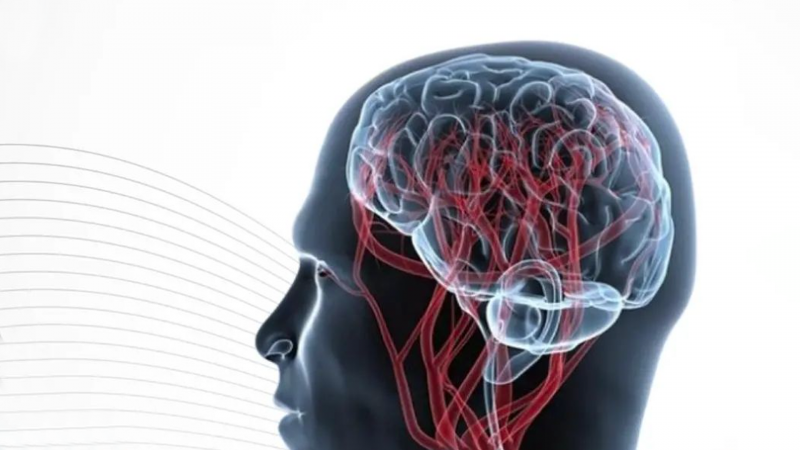 Malformacao Arteriovenosa